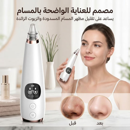 جهاز شفط الرؤوس السوداء